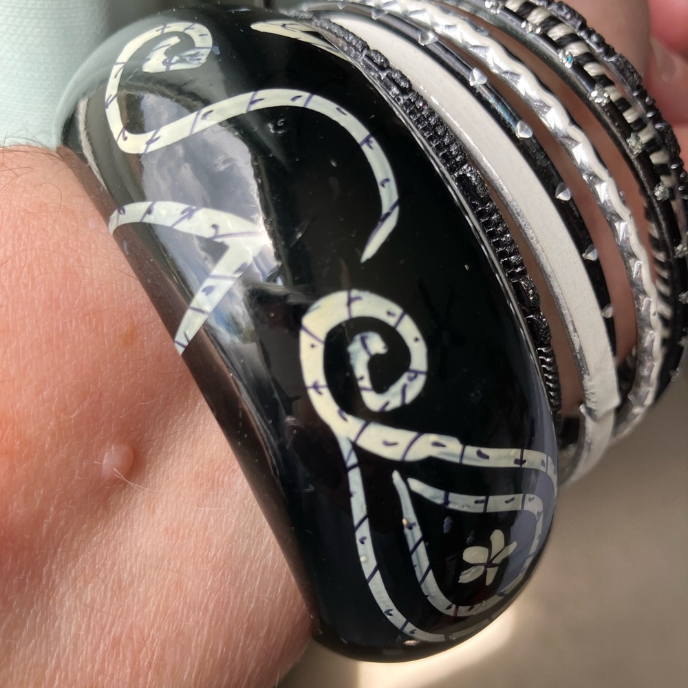 Elegant Black and White Bangle Set